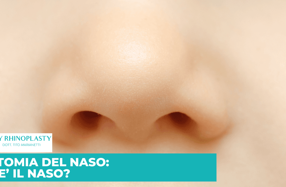 Naso