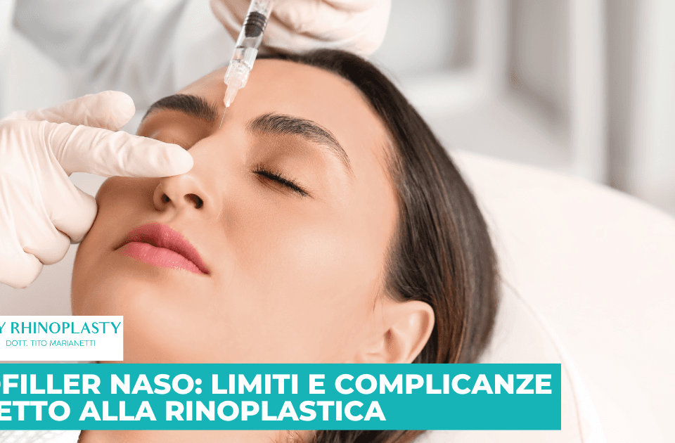 Rinofiller Naso